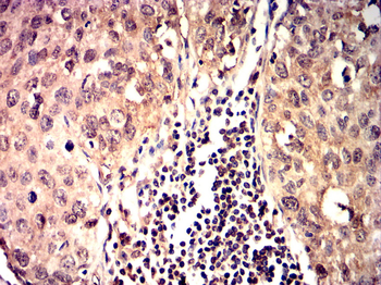 NFE2L2 Antibody