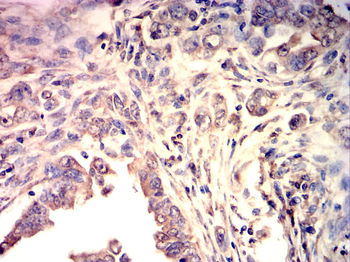 NFE2L2 Antibody