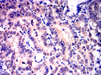 CASP8 Antibody