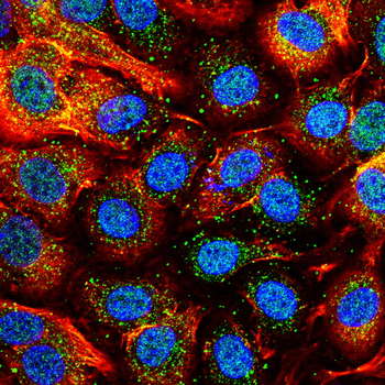 HMGB1 Antibody