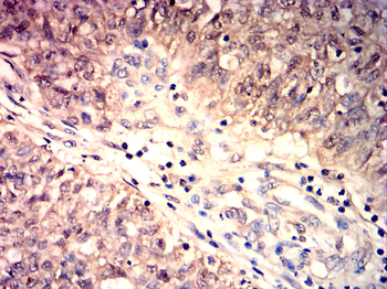 HSPA1A Antibody