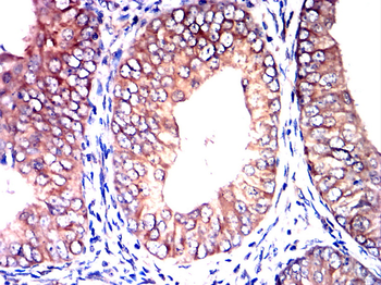 KIT Antibody