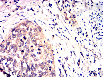 MAP2K1 Antibody