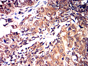 MAP2K1 Antibody