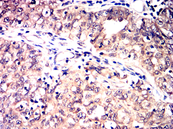MAP2K1 Antibody