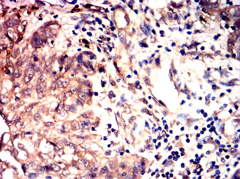 GSDMD Antibody