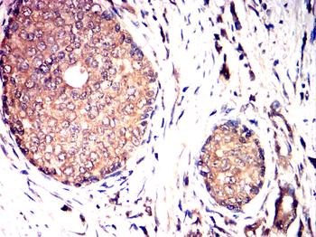 GSDMD Antibody
