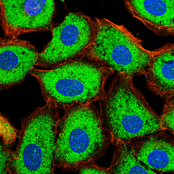MMP7 Antibody