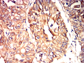 MMP7 Antibody
