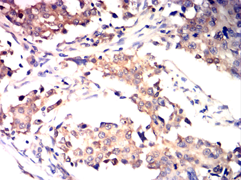 MMP7 Antibody