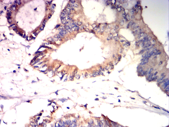 MMP7 Antibody