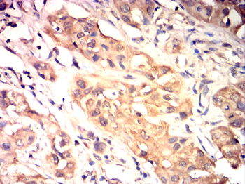 MMP7 Antibody
