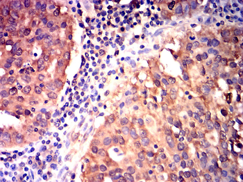 MMP7 Antibody