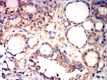 MMP7 Antibody