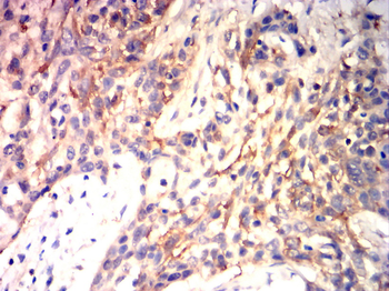 WNT1 Antibody