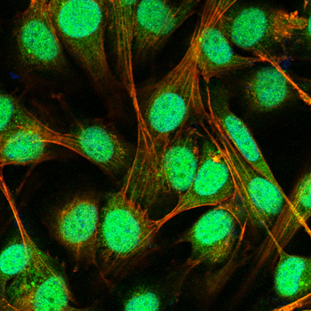 S100A4 Antibody