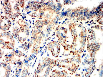 CYP11A1 Antibody