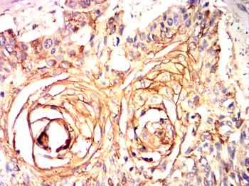 INS Antibody