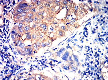 INS Antibody