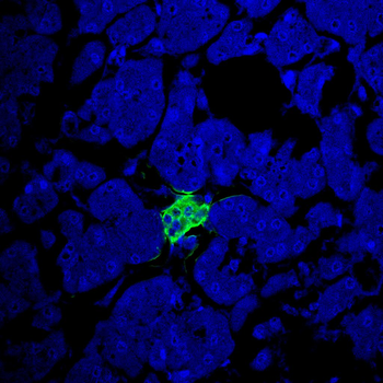 INS Antibody