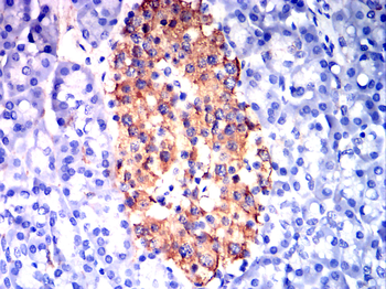 INS Antibody