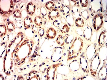 Mitofusin-1 Antibody