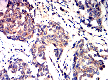 GLI1 Antibody