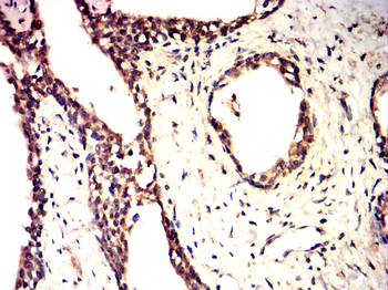 GLI1 Antibody
