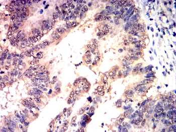 GLI1 Antibody