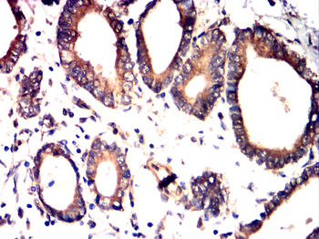 GLI1 Antibody