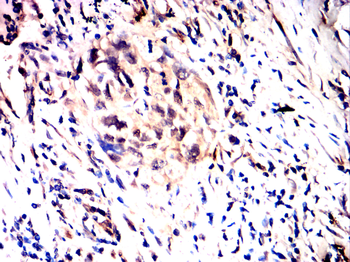 EPAS1 Antibody