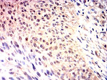 EPAS1 Antibody