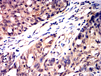 EPAS1 Antibody