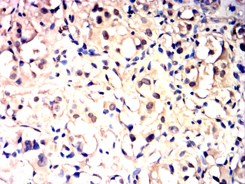 EPAS1 Antibody