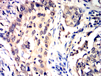 MMP9 Antibody