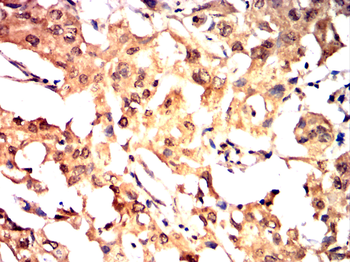 MMP9 Antibody