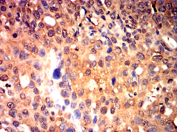 MMP9 Antibody