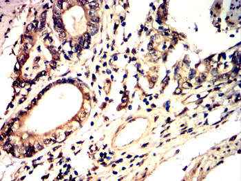MMP9 Antibody