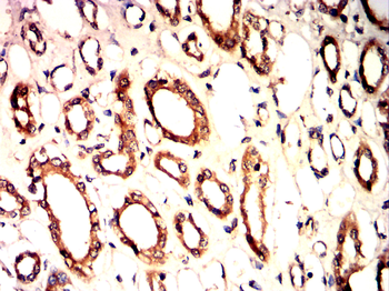 BAD Antibody