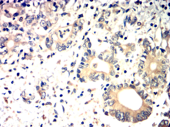 BAD Antibody