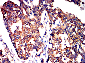 KRT19 Antibody