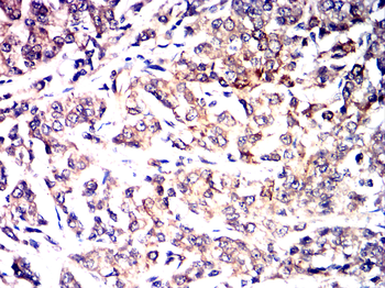 KRT19 Antibody