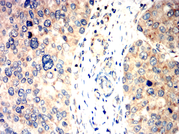CYP19A1 Antibody