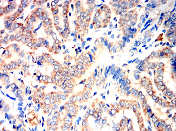 CYP19A1 Antibody