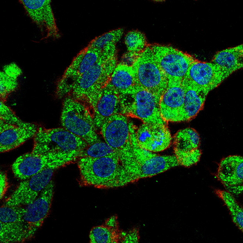 MMP13 Antibody