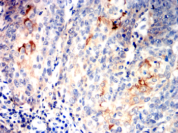 MMP13 Antibody