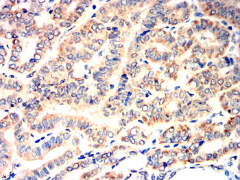 MMP13 Antibody