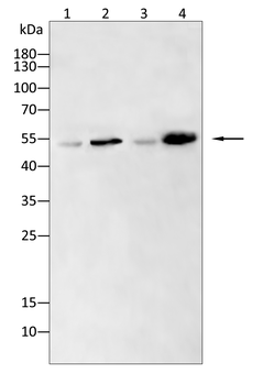 MMP13 Antibody