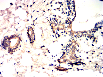 FOXO3 Antibody