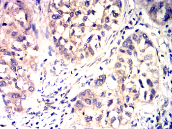 FOXO3 Antibody